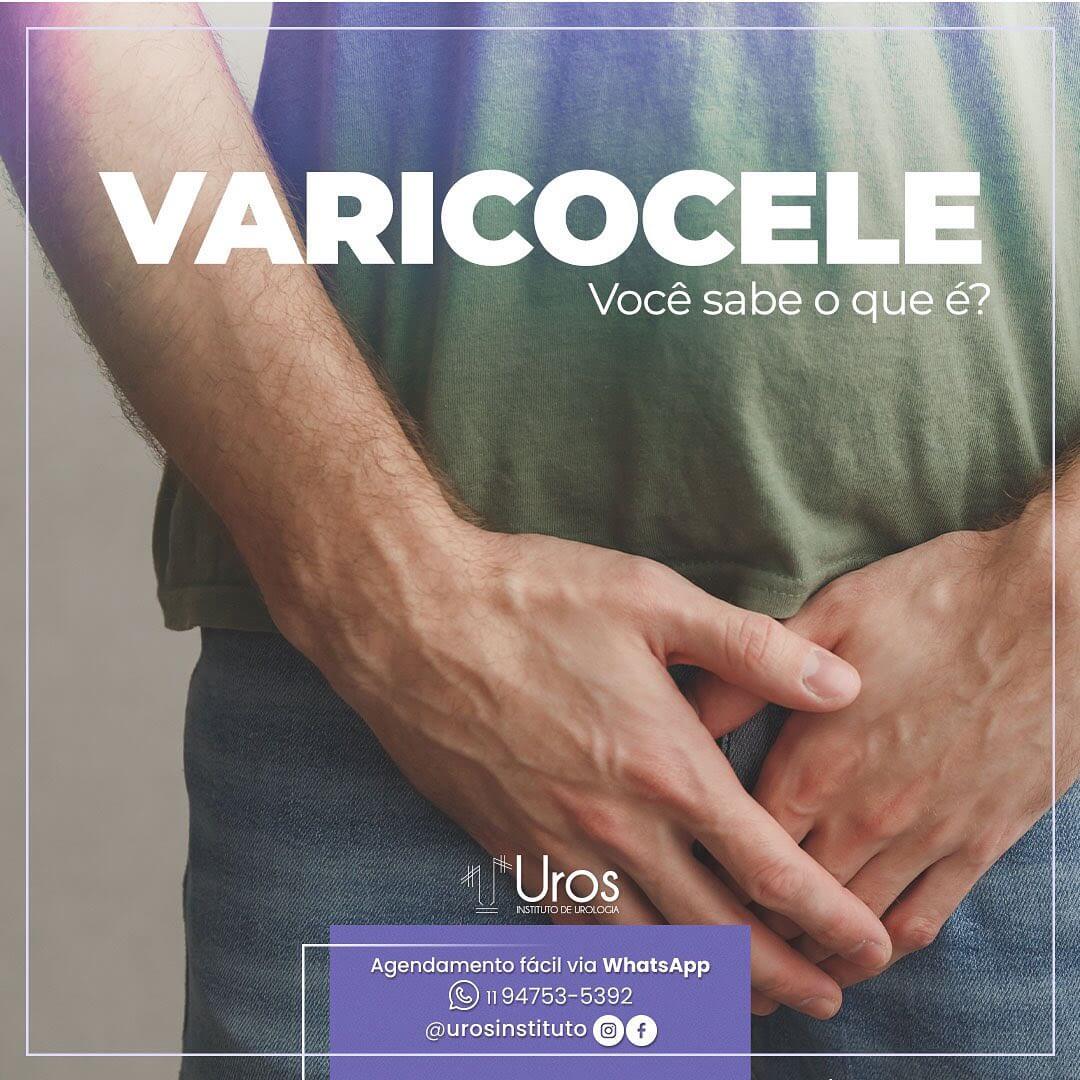 Varicocele UROS Instituto de Urologia